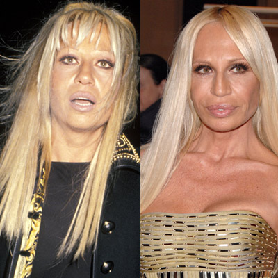 Woman and Time: #Donatella #Versace. Before and After 