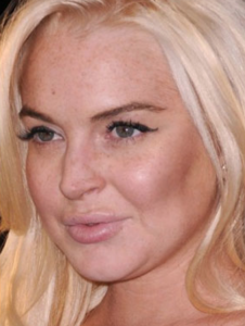 Lindsay Lohan: too much cheeks and too much lips