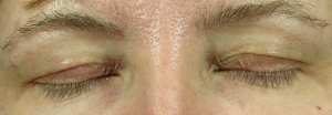 Eyelashes look sparse, irregular lengths, pale
