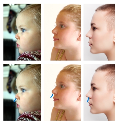 Profiles of a baby, a young girl and a woman showing the natural contour of the lips