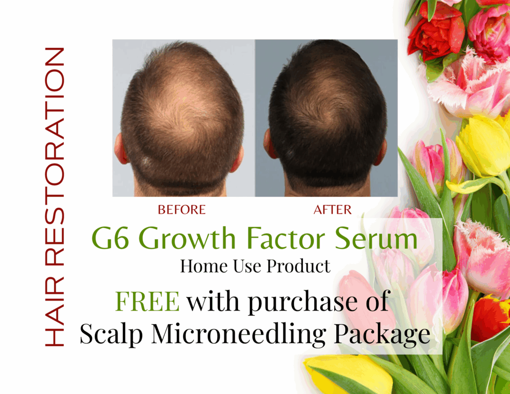 Hair Restoration: G6 Growth Factor Serum. Home Use Product - FREE with purchase of Scalp Microneedling Package