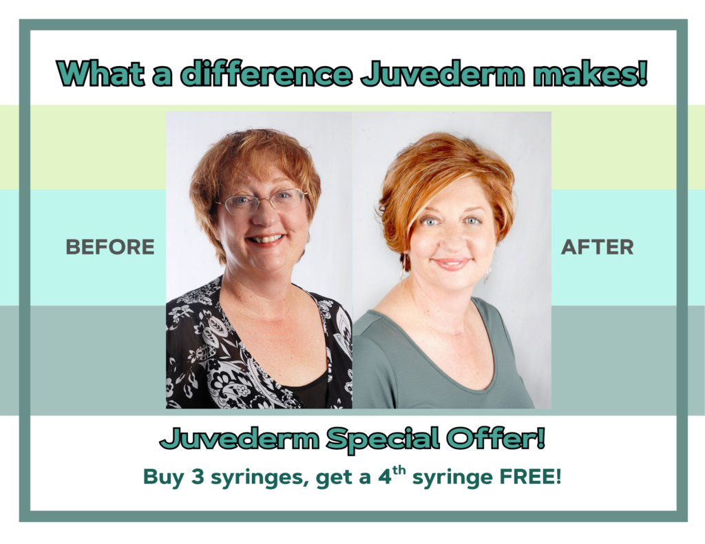 What a difference Juvederm makes! Juvederm special offer! Buy 3 syringes, get a 4th syringe free!