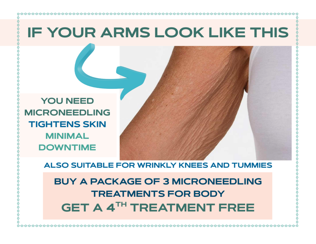 If your arms look wrinkly, you need microneedling: tightens skin, minimal downtime. Also suitable for wrinkly knees and tummies. Buy a package of 3 microneedling treatments for body get a 4th treatment free.