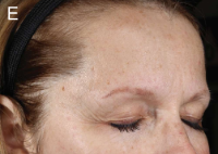 Older woman before using serum